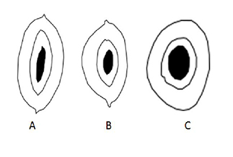 Comparación de los cambios en la forma de la base de los dientes
