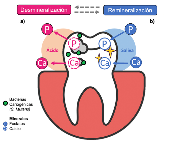 Caries como proceso de desmineralización y remineralización