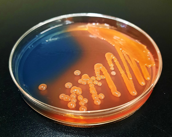 Colonias bacterianas de E. amylovora