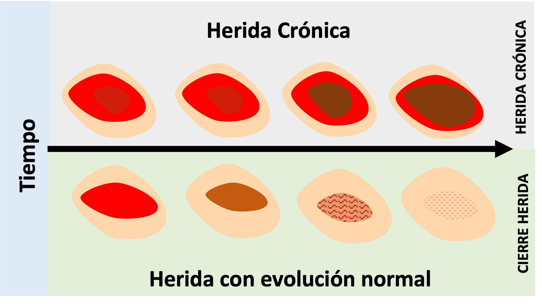 Comparación entre una herida crónica y una con evolución normal