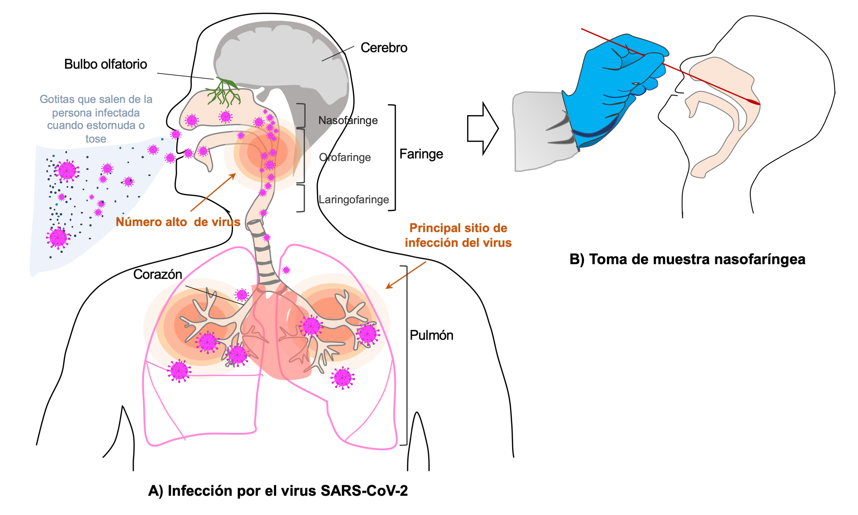 SARS-CoV-2 infección