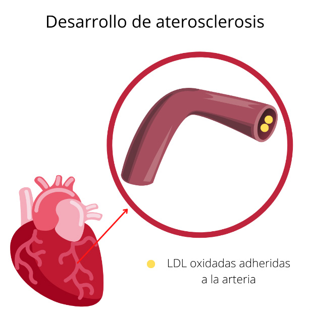 Desarrollo de aterosclerosis