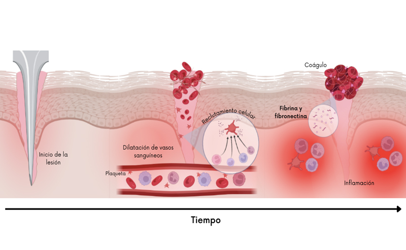 Fase de hemostásis y fase de inflamación