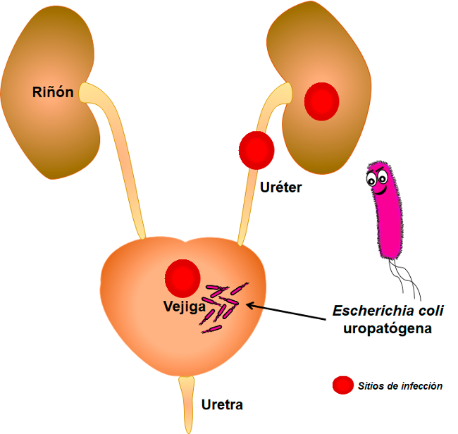 Partes del tracto urinario y sitios de infección